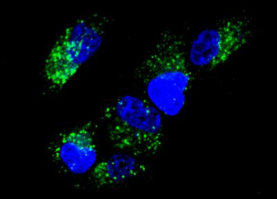 Studying gate in nucleic acid computing