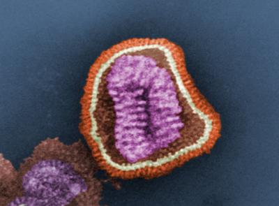 Microscope image of influenza virus particle
