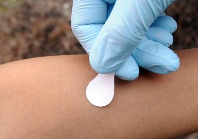 Applying a microneedle patch