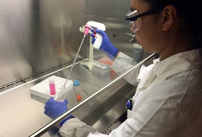 Pancreatic cancer cells and microRNA2