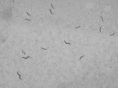 C. elegans lab strains under microscope