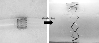 Stretchable Blood Flow Sensor
