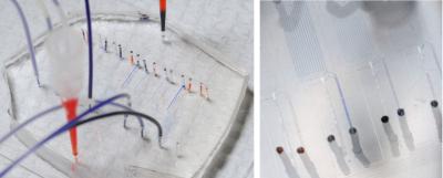 Microfluidic device