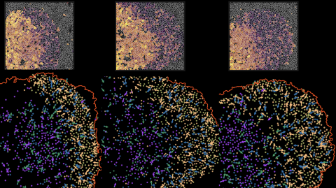 spatal metabololomics