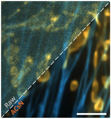 Figure: Dual-color image before and after ACsN denoising of F-actin (cyan) and mitochondria (orange) in fixed bovine pulmonary artery endothelial (BPAE) cells obtained by TIRF microscopy with an exposure time of 2 ms. Scale bar 4 um.