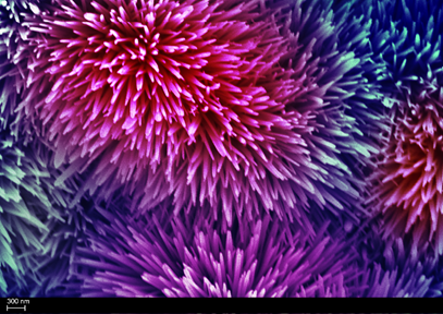 This image consists of many rods. The diameter of the rod is around 100 nanometers. So, they are called nanorods. The material of these nanorods is zinc oxide. Zinc oxide nanorods grow on a flat nickel metal substrate naturally and nicely, which look like fireworks.