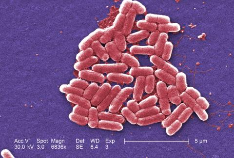 Microscope image of E. coli bacteria