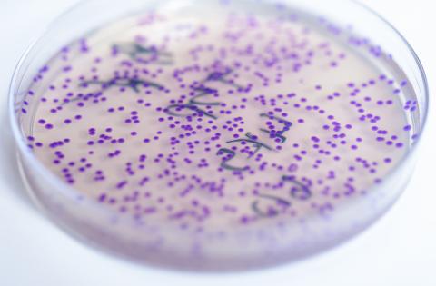 Plate containing E. coli
