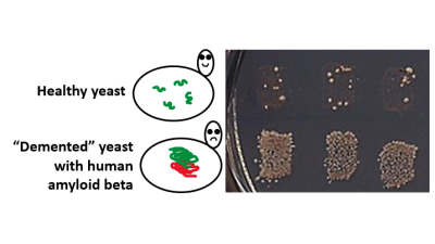 Healthy vs damaged yeast (Courtesy of Yury Chernoff)