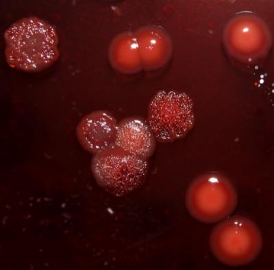 Researchers used a congo red agar (CRA) test to detect biofilms formed by P. Aeruginosa.