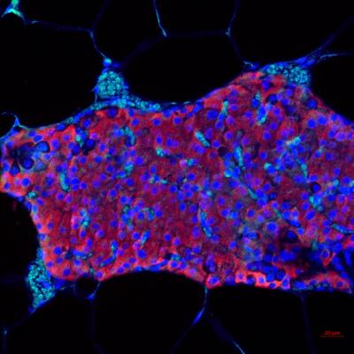 Transplanted islet cells