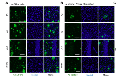 Before (left) and after images of reduced amyloid plaques in mice brains from a 2019 study. 