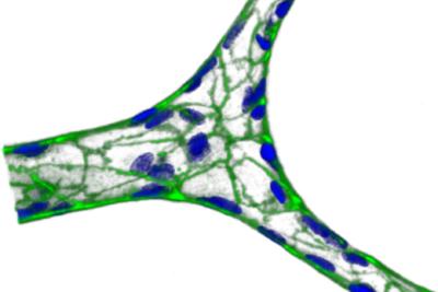 A miniature blood vessel, formed on agarose/gelatin hydrogel. Green represents VE-cadherin, a protein that glues cells together, and blue is nuclei. Courtesy of Yongzhi Qiu.