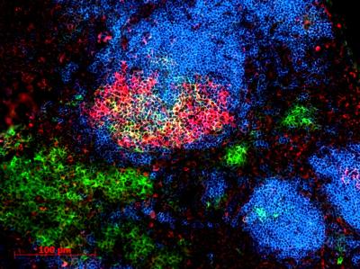 Blue shows resting B cells. Red shows activated B cells that are being &quot;trained&quot; to produce high-quality antibodies. Green shows specialized antibody-producing cells.