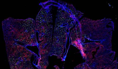 RSV Infected Mouse Lung
