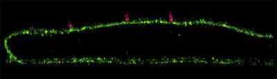 RSV Virus Particles on Cell