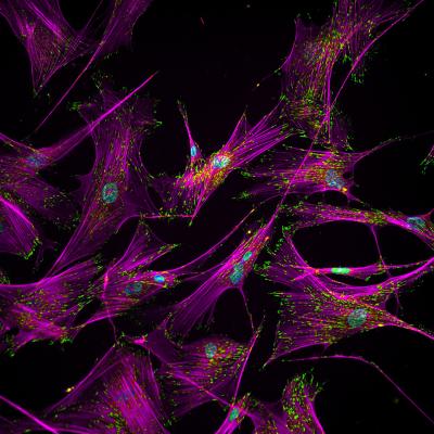 Stem cell separation human fibroblast cells