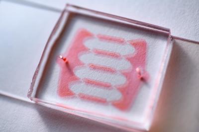 Microfluidic device for compressing cells