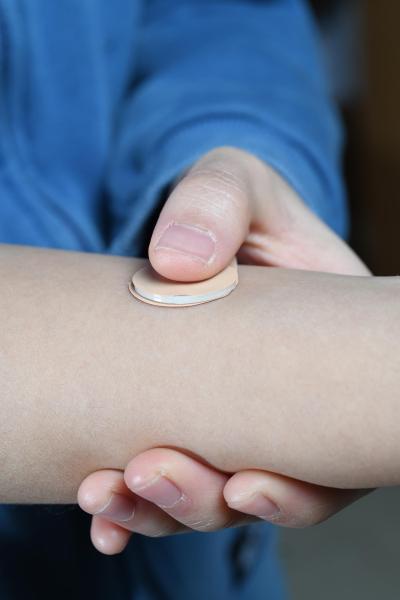 Simulated application of microneedle skin patch
