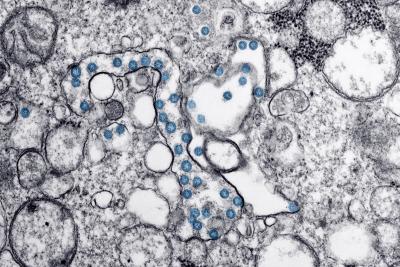 Coronavirus image