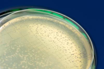Yeast colonies that survived DNA breakage
