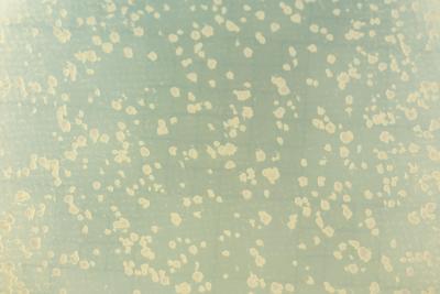 Yeast colonies that repaired DNA breakage