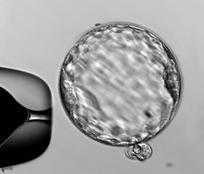 Embryonic stem cells are a blank slate having the potential to turn into cells that build parts of the body. Their use is also among the nation&#039;s -- and Georgia&#039;s -- most hot-button political issues.