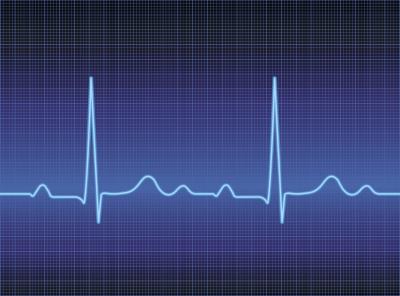 Tracing of electrocardiogram