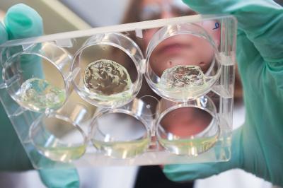 Hydrogel materials with pancreatic islet cells
