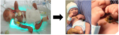 Neonates