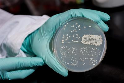 Budding yeast colonies