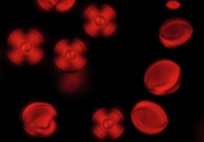 Liquid crystal tactoid droplets