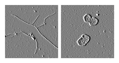 Toxic myocilin aggregates