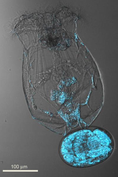 Female rotifer