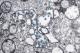 Transmission electron microscope image of coronavirus