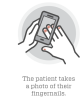 Smartphone anemia nails graphic