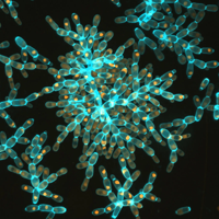 A snowflake-y clump of yeast cells