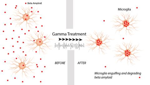 Gamma oscillation brain waves suppressed beta amyloid production and invigorated microglia