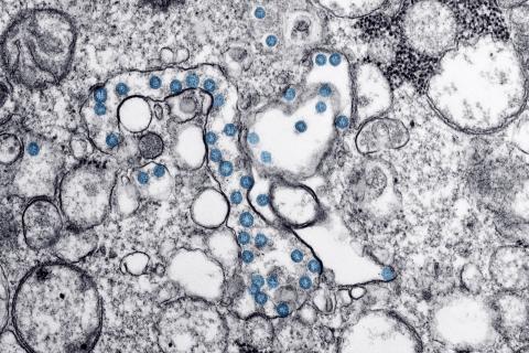 Microscope image of coronavirus