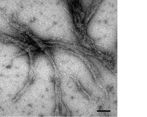 Amyloid fibril formations