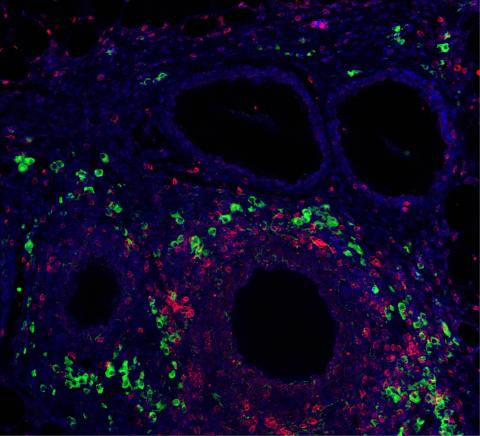 Immunomodulatory signal presentation