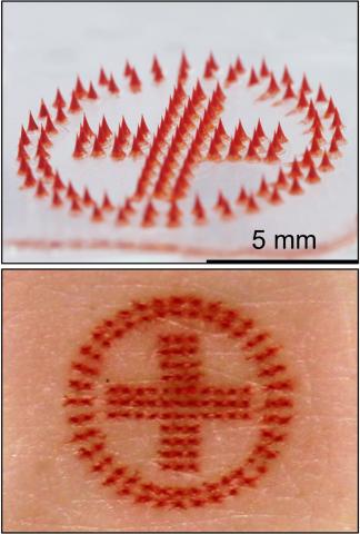 Medical alert tattoo