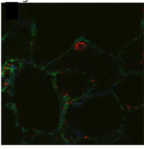 Molecular probes fibronectin strain lung tissue