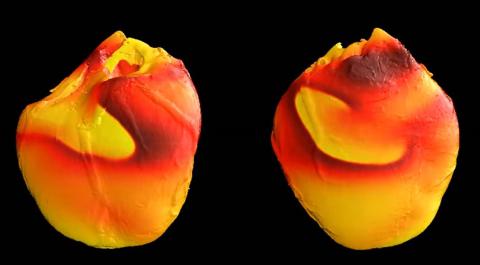 Simulated fibrillation in an animal heart