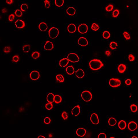 Cell membranes of prostate cancer cells