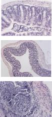 Colon tissue samples