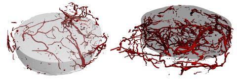 Hydrogel vasculature