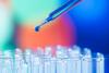 Dropper putting liquid into test tubes
