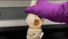 A gif showing how a meniscus implant works in a knee joint. 