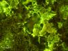 biofilm